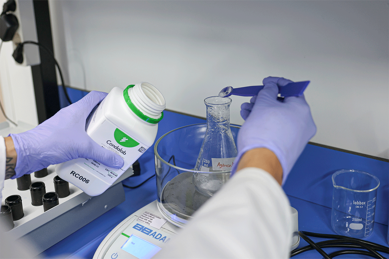 El equipo busca que los nanoanticuerpos actúen directamente en la zona "donde se origina y se expresa la enfermedad".
